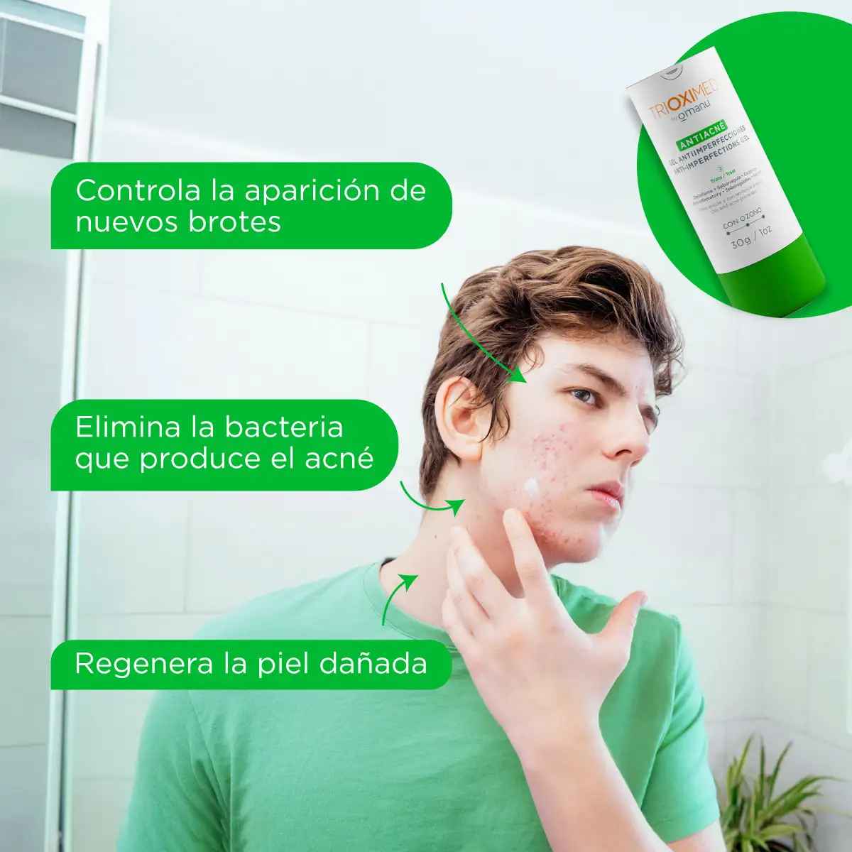 imagen-2-Antiacne-GelAntiimperfecciones-30g-Beneficios (1).webp